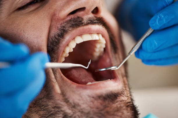 Best Walk-In Emergency Dentist in Linden, MI