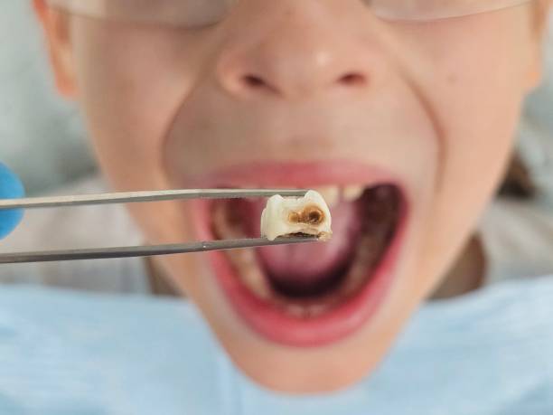 Best Emergency Dental Surgery in Linden, MI